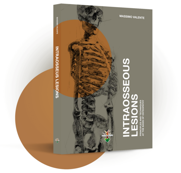 Official English Translation of “Intraosseous Lesions”